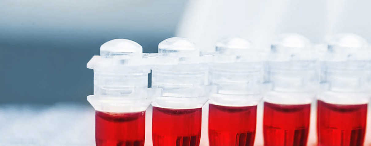 05labordiagnostik 1210x475px